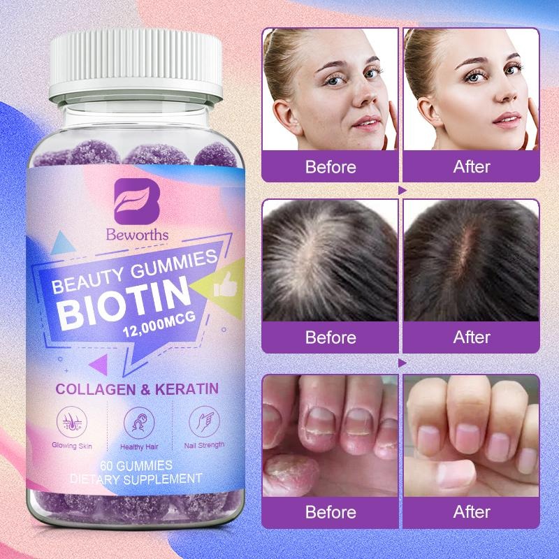 Beworths Beauty Biotin Gummies with Keratin & Collagen - 12000mcg